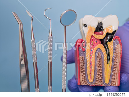 Dental tools and cross section tooth model in gloved hand on blue background 136850973