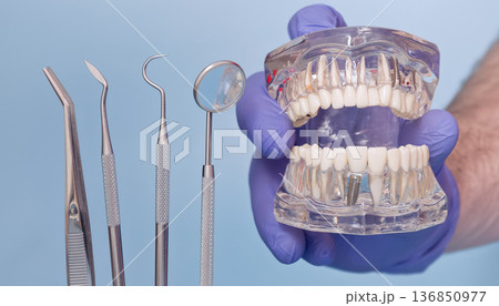 Open Dental Implant Jaw Model with Dentist Instruments and Blue Medical Gloves on Light Blue Background, Prosthetic Dentistry Concept 136850977