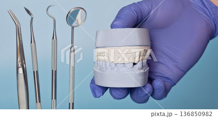 Dental Plaster Cast Jaw Model with Dentist Instruments in Blue Medical Glove on Light Blue Background, Prosthodontic Laboratory Concept 136850982