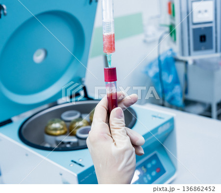 Platelet-Rich plasma preparation. Plasma in syringe. Centrifuge. 136862452