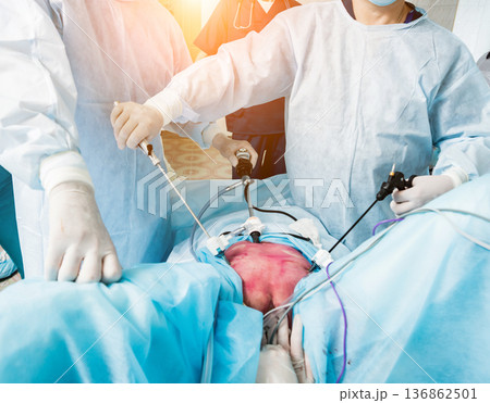 Process of gynecological surgery operation using laparoscopic equipment.  136862501