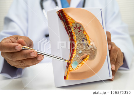 doctor holding female breast human anatomy model. 136875350