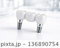 Dental Implants With Crowns Placed on a Clean Surface in a Clinic Setting During Daylight 136890754