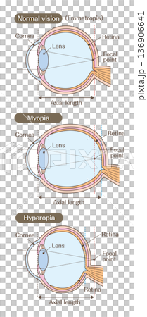 Diagram of the structure of the eye and refractive errors (normal, nearsighted, farsighted) 136906641