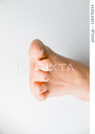 巻き爪・陥入爪の症状が出ている足の爪 136976834