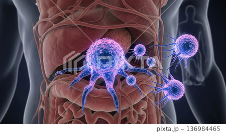 癌細胞のイメージ 136984465