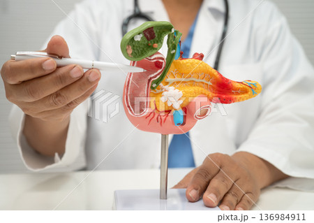 Pancreatitis, pancreatic cancer, Asian doctor with pancreas, gallbladder and bile duct human anatomy model at hospital. 136984911