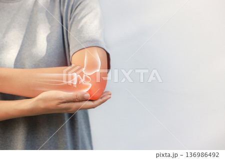 Asian woman suffering from elbow joint pain with red x-ray bone graphic overlay, female touching arm feeling ache from inflammation, arthritis, tendonitis or injury in garden, healthcare concept. 136986492