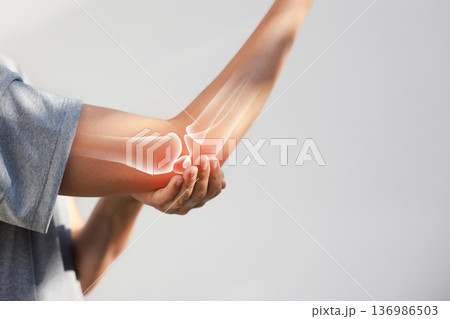 Asian woman suffering from elbow joint pain with red x-ray bone graphic overlay, female touching arm feeling ache from inflammation, arthritis, tendonitis or injury in garden, healthcare concept. 136986503