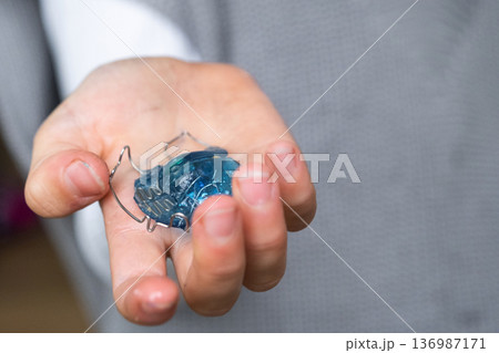Girl shows orthodontic expander plate, removable device for bite and palate correction, pediatric dental appliance. 136987171