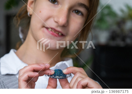 School-age girl demonstrates orthodontic appliance, blue plate for dental correction, oral health care. 136987175
