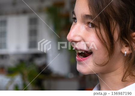 Portrait: girl age 9 after early orthodontic intervention, showing beautiful healthy smile. 136987190