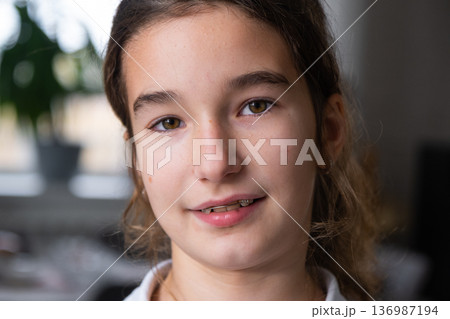 Smiling girl after jaw correction with orthodontic appliance, pediatric plate for straight teeth and healthy bite. 136987194