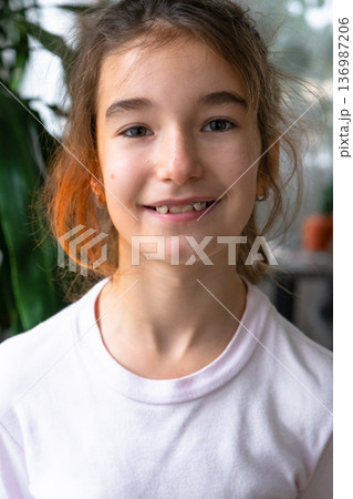 Portrait of schoolgirl with orthodontic expander, pediatric correction plate for proper bite and jaw growth. Portrait of schoolgirl with orthodontic expander, pediatric correction plate for proper bite and jaw growth. 136987206
