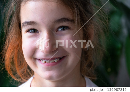 Portrait of school-age girl after correction plate, smiling confidently with aligned teeth and healthy bite. 136987213