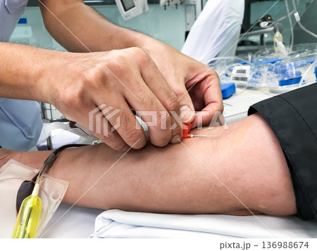 Blood platelet donation, a male nurse inserts a needle into donor arm to draw blood at a hospital. 136988674