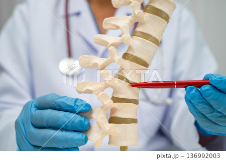 Doctor holding osteoporosis in back bone model for treatment medical in orthopedic department. Doctor holding osteoporosis in back bone model for treatment medical in orthopedic department. 136992003