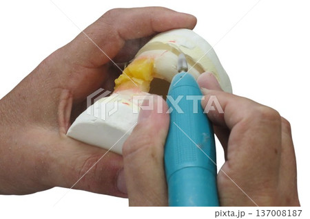Dental technician grinding prosthesis in a laboratory Dental technician grinding prosthesis in a laboratory 137008187