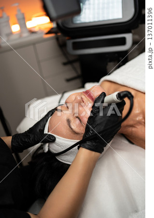 Professional beautician in black gloves applying advanced aesthetic treatment to a woman's face, performing skin rejuvenation 137011396
