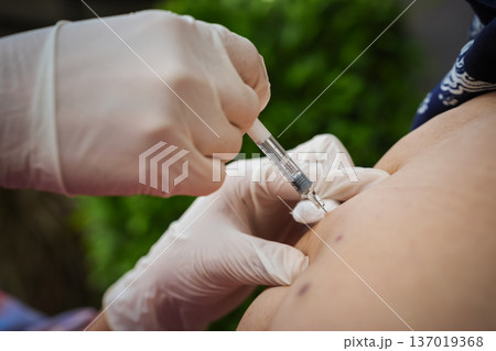 close up doctor is injecting enoxaparin injection to belly with syringe 137019368