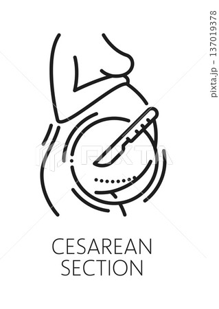 Cesarean section gynecology medical line icon or sign. Pregnancy healthcare outline sign, urinary health and woman fertility vector icon. Reproductive health, gynecology symbol with womb and scalpel 137019378