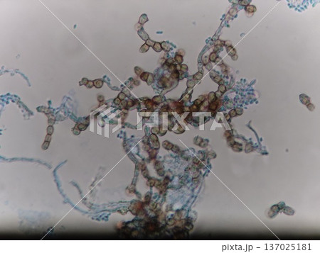 シリコンカバーについた黒かびの顕微鏡写真 137025181