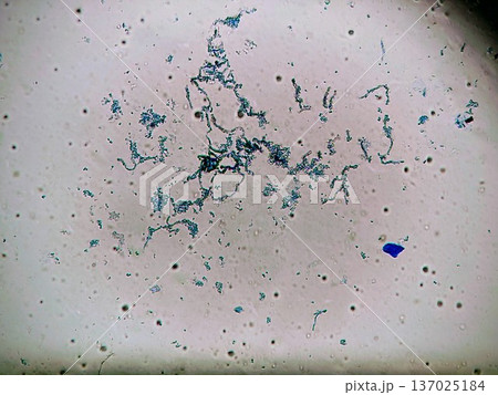 白いパッキンに生えた黒かびの様子 137025184