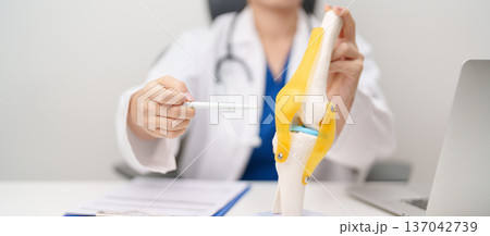 Doctor with Human Knee joint anatomy model. Osteoarthritis, Patellofemoral Pain Syndrome, Patellar Tendinitis, ACL, Anterior Cruciate Ligament, PCL, Posterior, MCL, Medial Collateral, LCL and Lateral Doctor with Human Knee joint anatomy model. Osteoarthritis, Patellofemoral Pain Syndrome, Patellar Tendinitis, ACL, Anterior Cruciate Ligament, PCL, Posterior, MCL, Medial Collateral, LCL and Lateral 137042739