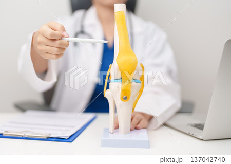 Doctor with Human Knee joint anatomy model. Osteoarthritis, Patellofemoral Pain Syndrome, Patellar Tendinitis, ACL, Anterior Cruciate Ligament, PCL, Posterior, MCL, Medial Collateral, LCL and Lateral Doctor with Human Knee joint anatomy model. Osteoarthritis, Patellofemoral Pain Syndrome, Patellar Tendinitis, ACL, Anterior Cruciate Ligament, PCL, Posterior, MCL, Medial Collateral, LCL and Lateral 137042740