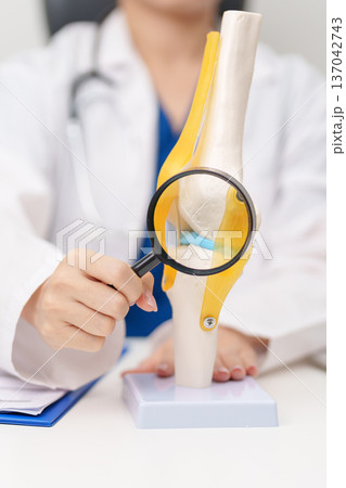 Doctor with Human Knee joint anatomy model. Osteoarthritis, Patellofemoral Pain Syndrome, Patellar Tendinitis, ACL, Anterior Cruciate Ligament, PCL, Posterior, MCL, Medial Collateral, LCL and Lateral Doctor with Human Knee joint anatomy model. Osteoarthritis, Patellofemoral Pain Syndrome, Patellar Tendinitis, ACL, Anterior Cruciate Ligament, PCL, Posterior, MCL, Medial Collateral, LCL and Lateral 137042743