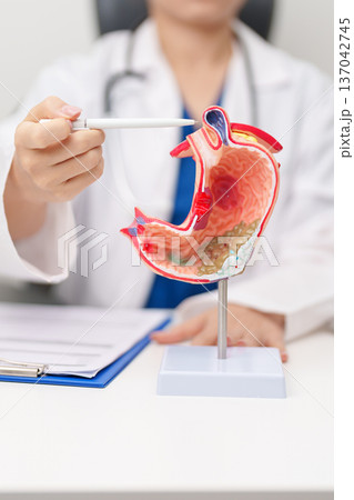 Doctor with Gastric anatomy model. Gastroenterologist consultation, stomach diseases and ulcers, November stomach cancer, Gastroesophageal Reflux Disease, GERD, Acid reflux and healthcare medical Doctor with Gastric anatomy model. Gastroenterologist consultation, stomach diseases and ulcers, November stomach cancer, Gastroesophageal Reflux Disease, GERD, Acid reflux and healthcare medical 137042745