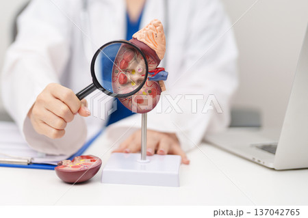 Doctor with Kidney Adrenal gland anatomy model. disease of Urinary system and Stones, Cancer, world kidney day, Chronic kidney, Urology, Nephritis, Renal, Transplant and health concept 137042765