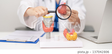 Doctor with human Thyroid anatomy model. Hyperthyroidism, Hypothyroidism, Hashimoto Thyroiditis, Thyroid Tumor and Cancer, Postpartum, Papillary Carcinoma and Health concept Doctor with human Thyroid anatomy model. Hyperthyroidism, Hypothyroidism, Hashimoto Thyroiditis, Thyroid Tumor and Cancer, Postpartum, Papillary Carcinoma and Health concept 137042806