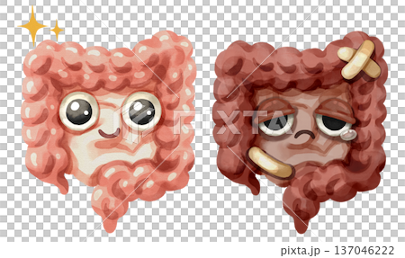 Watercolor cartoon comparison of a healthy intestine and unhealthy intestine. Representing conditions like colon cancer, irritable bowel syndrome, gut microbiome balance. Transparent background. 137046222