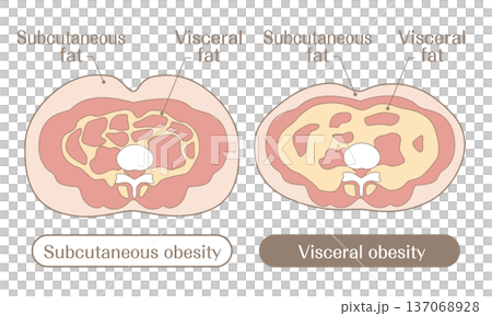 圖示比較皮下脂肪肥胖和內臟脂肪肥胖 137068928