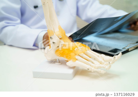 Doctor examining foot ankle joint bone radiography xray film. Doctor examining foot ankle joint bone radiography xray film. 137116029