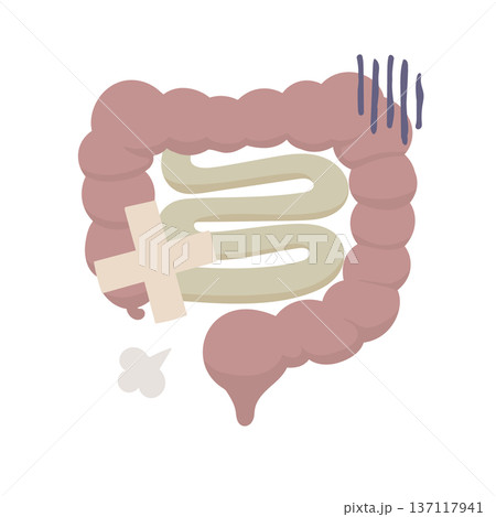 絆創膏が貼られた不健康そうな腸のイラスト 絆創膏が貼られた不健康そうな腸のイラスト 137117941