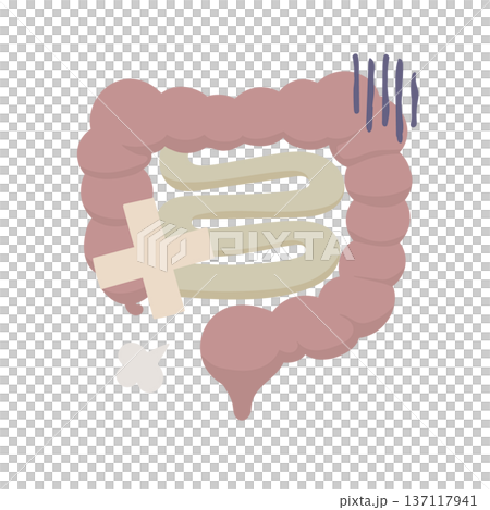 絆創膏が貼られた不健康そうな腸のイラスト 絆創膏が貼られた不健康そうな腸のイラスト 137117941