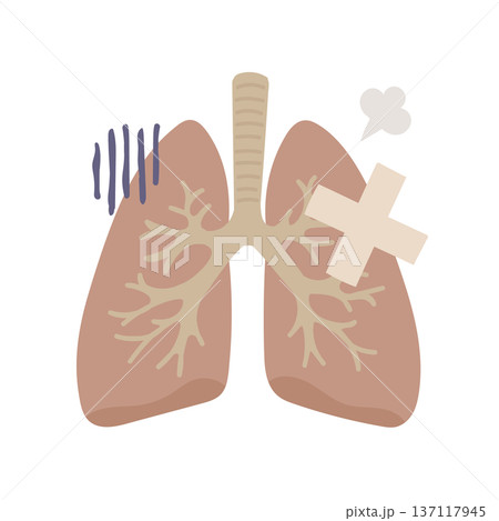 絆創膏が貼られた不健康そうな肺のイラスト 137117945
