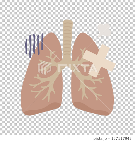 絆創膏が貼られた不健康そうな肺のイラスト 137117945