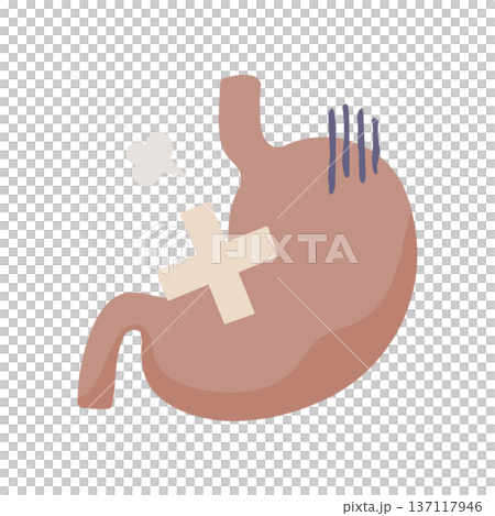 Illustration of an unhealthy stomach with a bandage attached 137117946