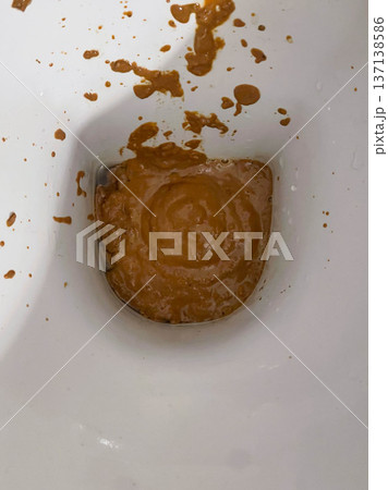 White toilet filled with human excrement White toilet filled with human excrement 137138586