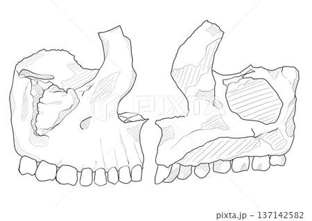 上顎骨 Maxilla 上顎骨 Maxilla 137142582