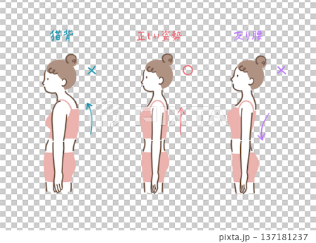 對比插圖，展示了從側面看到的正確姿勢與駝背和拱背女性的姿勢。 137181237