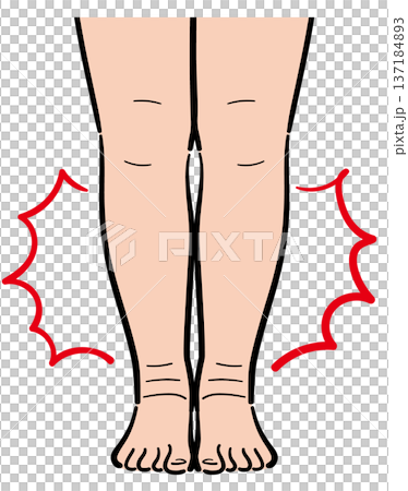 腿部腫脹 137184893