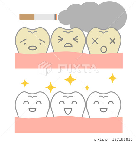 タバコのヤニ汚れから白い歯へ歯のキャラクタービフォーアフターのイラストセット 137196810