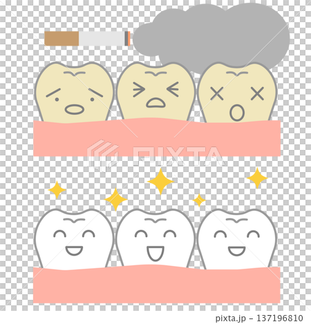 タバコのヤニ汚れから白い歯へ歯のキャラクタービフォーアフターのイラストセット 137196810