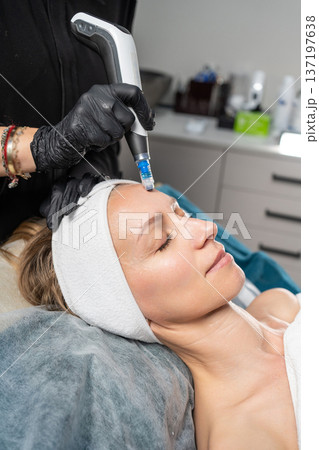 Woman lying down receiving microneedling treatment on her forehead for skin rejuvenation 137197638