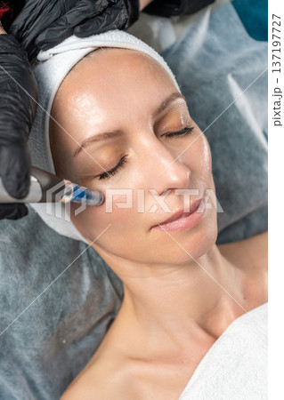 Woman having an aesthetic microneedling dermapen procedure for skin rejuvenation Woman having an aesthetic microneedling dermapen procedure for skin rejuvenation 137197727