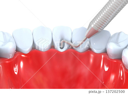 Professional teeth cleaning Professional teeth cleaning 137202500